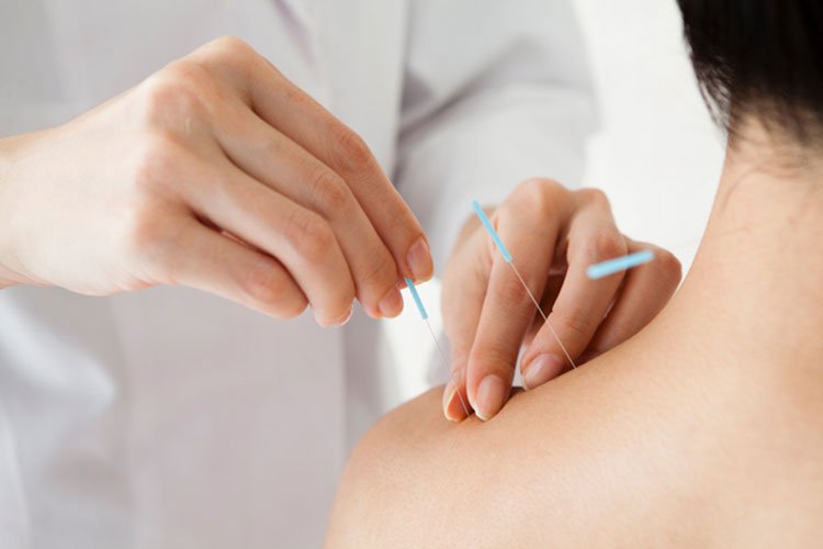 CẬP NHẬT TIẾN BỘ CƠ CHẾ TÁC DỤNG CHÂM CỨU THEO Y HỌC CỔ TRUYỀN & Y HỌC HIỆN ĐẠI