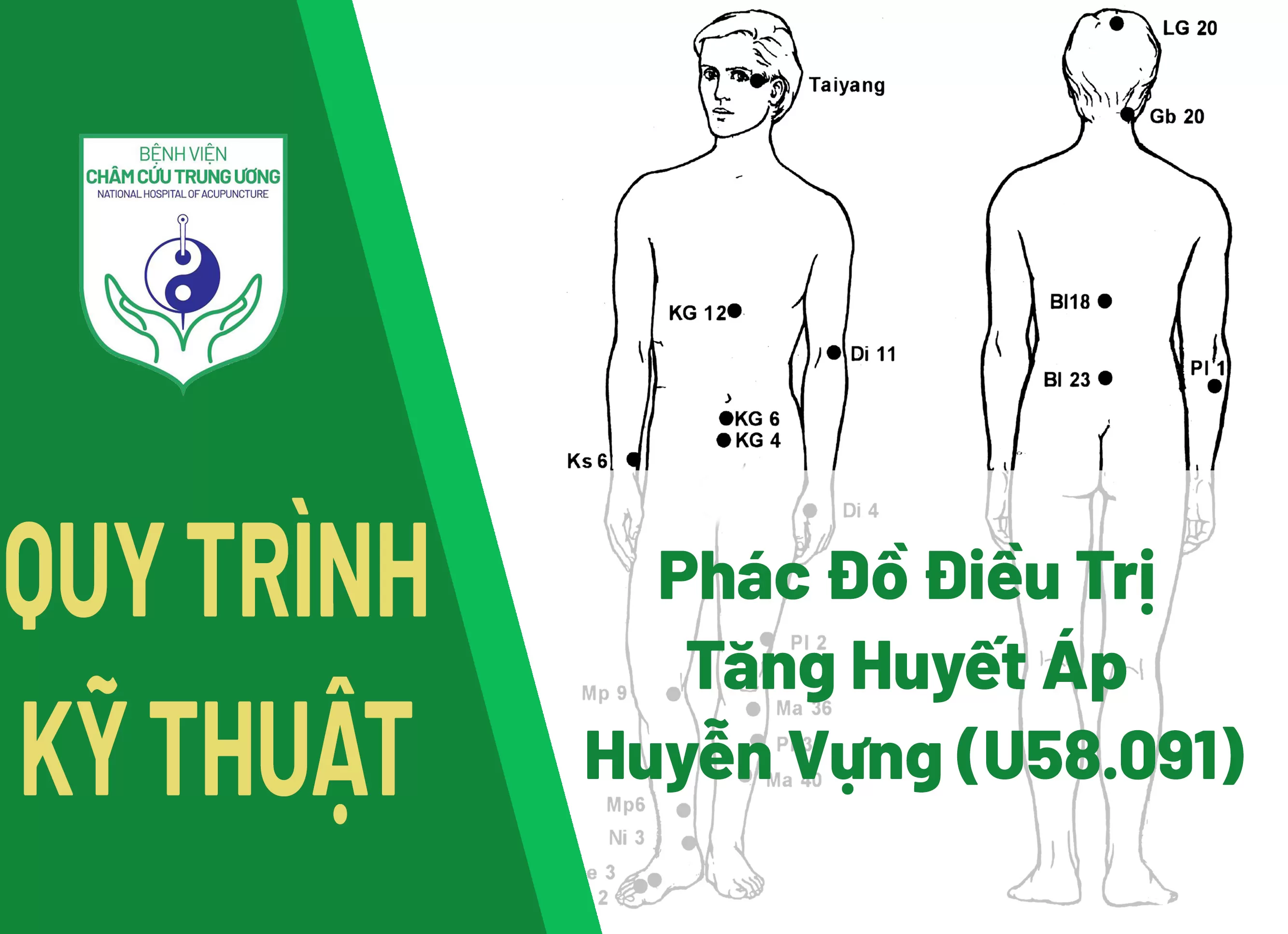 Phác Đồ Điều Trị Tăng Huyết Áp - Huyễn Vựng (U58.091)