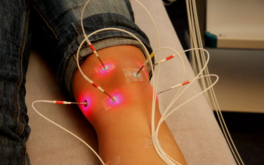 Laser châm là gì? Những người nào có thể áp dụng phương pháp laser châm?