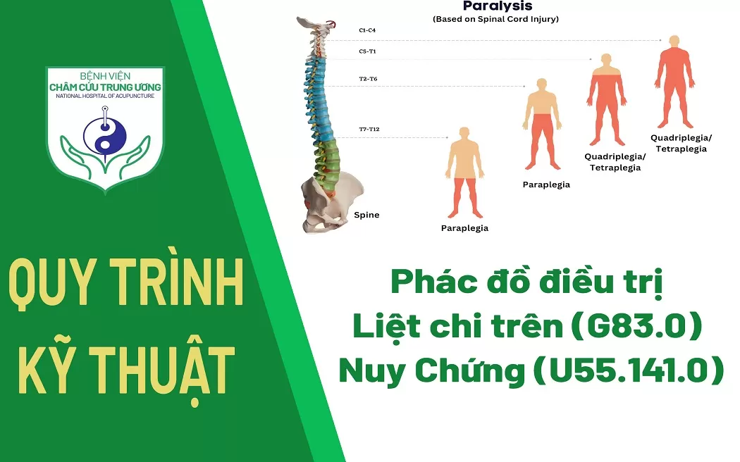 Phác đồ điều trị Liệt chi trên (G83.0) - Nuy Chứng (U55.141.0)