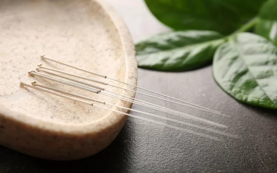 Hỗ trợ cai nghiện bằng châm cứu: Mức độ hiệu quả đến đâu và các câu hỏi thường gặp