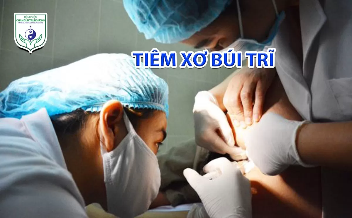 Tiêm xơ búi trĩ