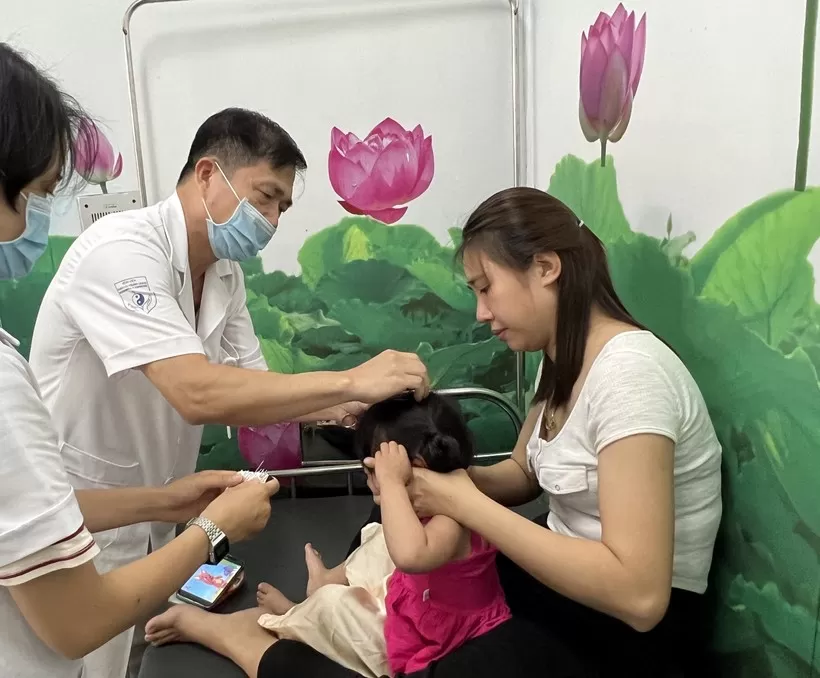 Châm cứu điều trị bại não, tự kỷ ở trẻ em