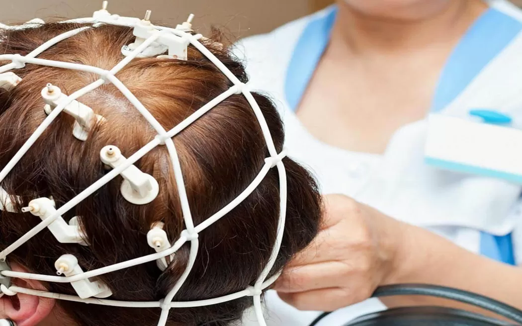 Đo lưu huyết não: Tác dụng và cách đọc kết quả sơ lược dễ hiểu