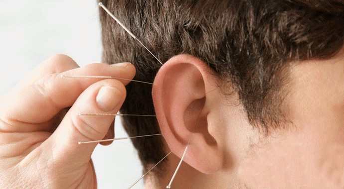 Đánh giá tác dụng của phương pháp điện châm kết hợp nhĩ châm trong điều trị rối loạn giấc ngủ thể can đởm hỏa vượng