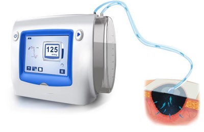 ĐÁNH GIÁ HIỆU QUẢ CỦA PHƯƠNG PHÁP HÚT ÁP LỰC  M TRONG ĐIỀU TRỊ VẾT LOÉT TẠI BỆNH VIỆN CH M CỨU  TW