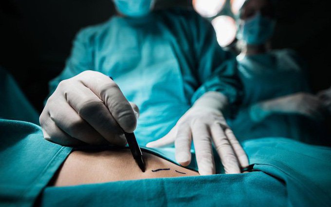 ĐẶC ĐIỂM LÂM SÀNG VÀ ĐÁNH GIÁ KẾT QUẢ CHĂM SÓC BỆNH NHÂN SAU PHẪU THUẬT BƯỚU GIÁP ĐƠN THUẦN TẠI KHOA NGOẠI CHÂM TÊ BỆNH VIỆN CHÂM CỨU TRUNG ƯƠNG
