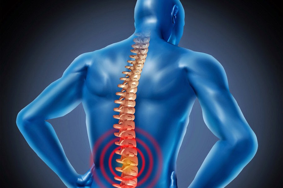 Đánh giá hiệu quả xoa bóp bấm huyệt kết hợp chăm sóc điều dưỡng cho bệnh nhân đau thắt lưng do thoái hóa cột sống