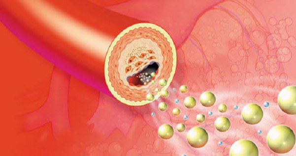 THỰC TRẠNG RỐI LOẠN   LIPID MÁU Ở BỆNH NHÂN ĐÁI THÁO ĐƯỜNG TYP 2 TẠI BỆNH VIỆN CHÂM CỨU TRUNG ƯƠNG NĂM