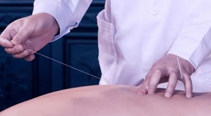 Đại trường châm - Mãng châm