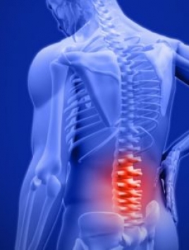 Chụp X-quang cột sống thắt lưng thẳng nghiêng